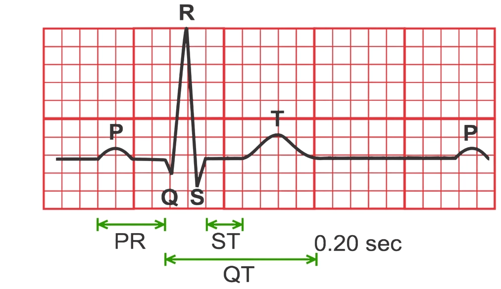 An ECG waveform diagram plotted on a standard red grid detailing key cardiac intervals and segments. The tracing shows labeled components including the P wave, QRS complex (with Q, R, and S deflections), T wave, and a subsequent P wave. Green bidirectional arrows mark major measurement spans: the PR interval from the onset of the P wave to the start of the QRS complex, the ST segment from the end of the S wave to the onset of the T wave, and the QT interval spanning from the start of the Q wave to the end of the T wave, with a time reference of 0.20 sec indicating the duration of one large grid box.