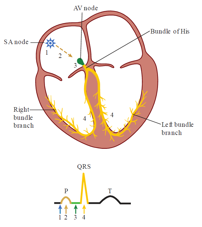 A diagram mapping cardiac electrical conduction to corresponding ECG waveform components. Top panel: A four-chamber heart diagram highlights four numbered conduction steps: 1. SA node firing in the right atrium, 2. atrial conduction pathway, 3. AV node and Bundle of His, and 4. Right bundle branch and Left bundle branch spreading through the ventricular myocardium. Bottom panel: An ECG tracing correlates these steps using color-coded numbered arrows: arrow 1 (blue) marks SA node activation, arrow 2 (brown) corresponds to the P wave (atrial depolarization), arrow 3 (green) marks the PR segment (AV node conduction delay), and arrow 4 (yellow) corresponds to the QRS complex (ventricular depolarization).