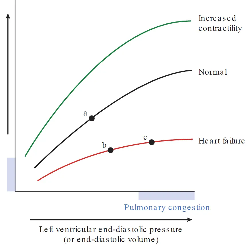 A Frank-Starling curve plotting ventricular stroke volume or cardiac output on the y-axis against left ventricular end-diastolic pressure or volume on the x-axis. Three curves are shown: "Increased contractility" (top green curve), "Normal" (middle black curve with baseline point "a"), and "Heart failure" (bottom red curve shifted downward). Points "b" and "c" on the heart failure curve demonstrate how increasing preload yields minimal gains in stroke volume while entering the "Pulmonary congestion" region highlighted along the x-axis.