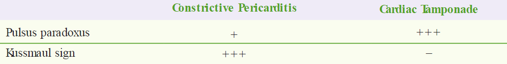 A comparison table contrasting clinical signs between Constrictive Pericarditis and Cardiac Tamponade. The table lists two physical exam findings: Pulsus paradoxus is less common in Constrictive Pericarditis (+) but prominent in Cardiac Tamponade (+++); whereas Kussmaul sign is characteristically present in Constrictive Pericarditis (+++) and absent in Cardiac Tamponade (-).