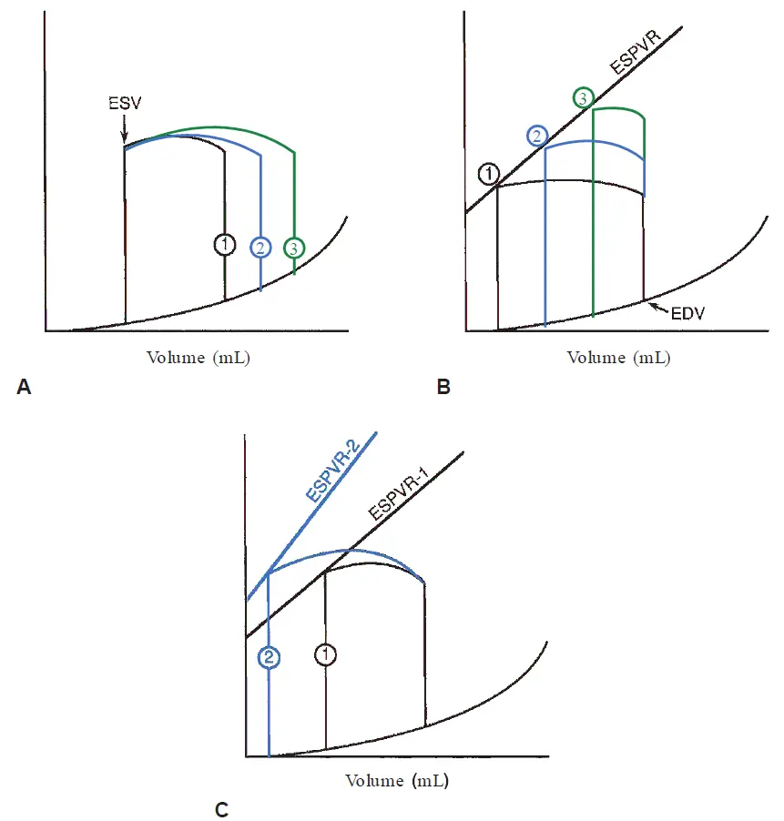Three ventricular pressure-volume loops labeled A, B, and C illustrating cardiac mechanics. Panel A shows that increasing preload (end-diastolic volume) increases stroke volume while end-systolic volume remains constant. Panel B shows that increasing afterload decreases stroke volume and increases end-systolic volume along a linear End-Systolic Pressure-Volume Relationship (ESPVR) line. Panel C demonstrates that a positive inotropic state shifts the ESPVR line upward and to the left (from ESPVR-1 to ESPVR-2), increasing stroke volume and decreasing end-systolic volume.