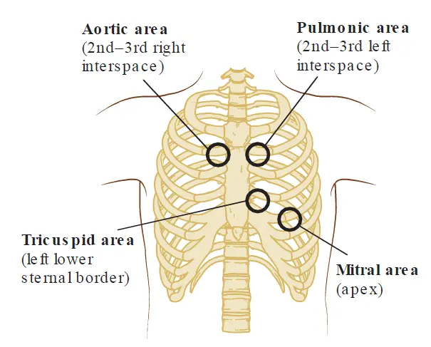Anatomical diagram mapping the four primary cardiac auscultation areas on a human rib cage illustration. Black circles indicate stethoscopic placement locations, labeled as: Aortic area (2nd–3rd right interspace), Pulmonic area (2nd–3rd left interspace), Tricuspid area (left lower sternal border), and Mitral area (apex).