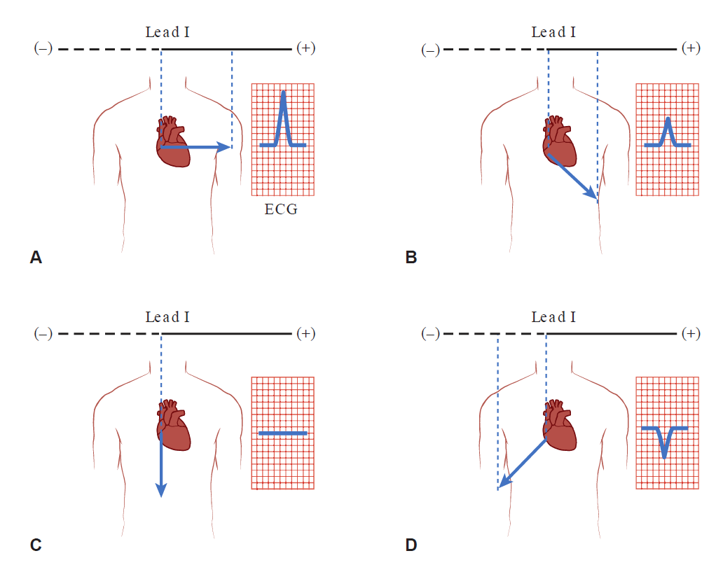 A four-panel diagram (A, B, C, D) demonstrating how cardiac electrical vector orientation affects the amplitude and direction of the ECG waveform recorded in Lead I. Panel A: A vector parallel to Lead I pointing directly toward the positive (+) electrode yields a maximum positive (upward) deflection on the ECG trace. Panel B: A vector directed obliquely down and toward the left yields a moderately positive deflection. Panel C: A vertical vector perpendicular to Lead I projects no voltage onto the Lead I axis, yielding a flat isoelectric line on the ECG. Panel D: A vector pointing down and to the right, away from the positive electrode, yields a negative (downward) deflection.