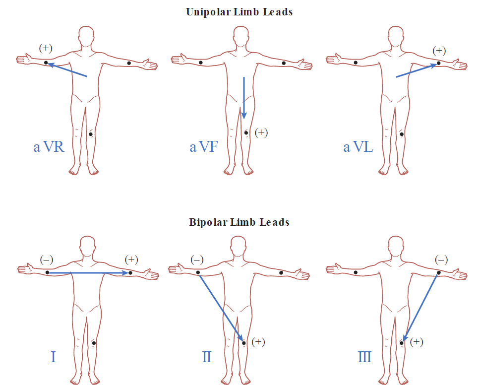 A diagram illustrating the electrical vectors for ECG Unipolar Limb Leads and Bipolar Limb Leads across six human body outlines. Top row (Unipolar Limb Leads): aVR shows a vector pointing toward the positive electrode on the right arm (+); aVF shows a vector pointing downward toward the positive electrode on the left leg (+); aVL shows a vector pointing toward the positive electrode on the left arm (+). Bottom row (Bipolar Limb Leads): Lead I shows a horizontal vector running from the right arm (-) to the left arm (+); Lead II shows a diagonal vector running from the right arm (-) to the left leg (+); Lead III shows a diagonal vector running from the left arm (-) to the left leg (+).