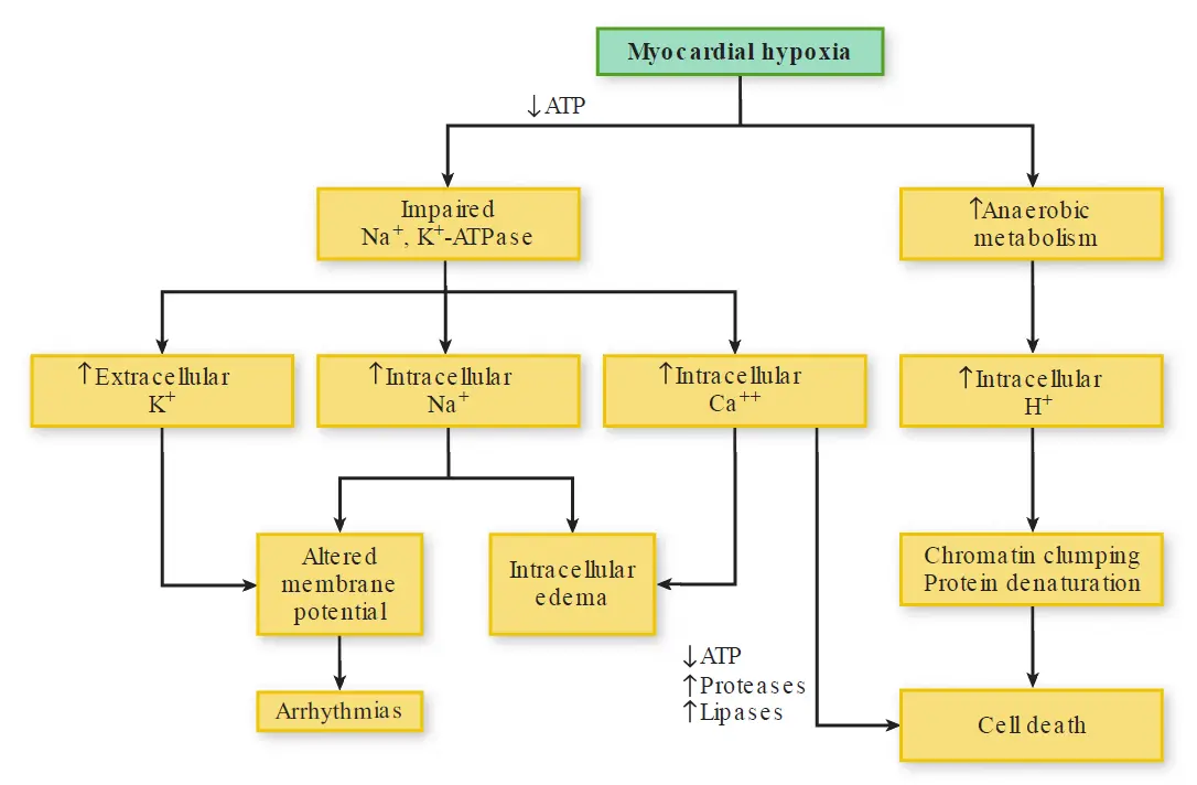 Flowchart illustrating the cellular mechanisms of cell death during myocardial hypoxia, showing ATP depletion, ion imbalances, edema, arrhythmias, and necrosis.