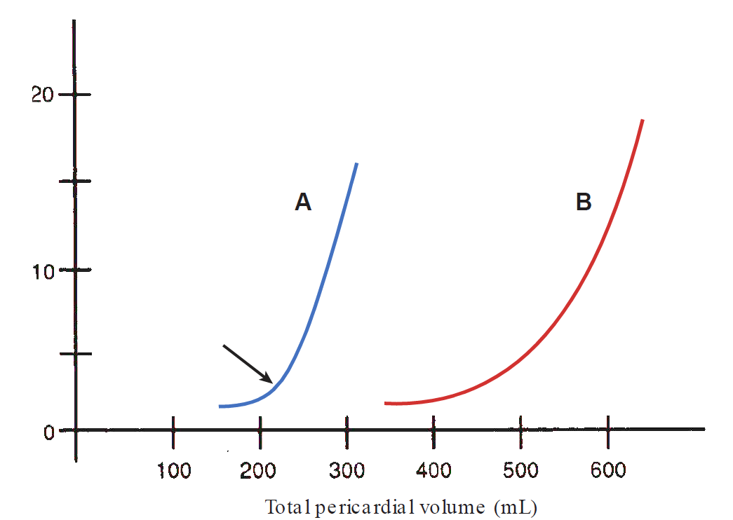 A graph illustrating the non-linear relationship between pericardial pressure and total pericardial volume under acute and chronic fluid accumulation conditions. The vertical axis measures pericardial pressure in mmHg from 0 to 20, while the horizontal axis displays Total pericardial volume in mL ranging from 100 to 600. Curve A (blue) represents acute fluid accumulation: it begins flat around 150 to 200 mL, but after a critical volume threshold around 220 mL (indicated by a black arrow), the curve bends sharply upward, showing a steep, dramatic increase in pressure with small additional volume additions. Curve B (red) represents slow, chronic fluid accumulation where the pericardium stretches and adapts over time; this shifts the entire curve to the right, allowing the pericardium to accommodate larger volumes (up to 500–600 mL) before experiencing a rapid spike in pressure.