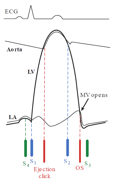 A physiological pressure graph aligning cardiac pressure curves with normal and extra heart sounds relative to an ECG trace at the top. The graph plots the pressure changes over time within the aorta, left ventricle (LV), and left atrium (LA), highlighting the point where the mitral valve opens (MV opens). At the bottom, standard heart sounds S1 and S2 (blue bars) are shown alongside extra cardiac sounds: S4 (green), an Ejection click (red), an Opening Snap (OS, red), and S3 (green).