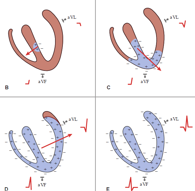 A four-panel diagram (B, C, D, E) showing the sequence of ventricular depolarization and corresponding ECG trace developments in leads aVF and aVL. Panel B: Depolarization begins in the midportion of the interventricular septum with a red vector arrow pointing rightward and inferiorly, generating an initial small upward deflection in lead aVF and a small downward deflection in lead aVL. Panel C: Depolarization spreads down the septum toward the apex with the vector arrow pointing strongly inferiorly and slightly leftward, producing a large upward R-wave peak in lead aVF and initiating an upward deflection in lead aVL. Panel D: Depolarization spreads through the thick lateral wall of the left ventricle with the dominant vector arrow pointing leftward and superiorly toward aVL, causing the peak R wave in lead aVL while the aVF trace begins returning toward baseline. Panel E: Both ventricles are fully depolarized (entire myocardium shaded in blue with negative charges outside), causing the electrical vector to disappear and both ECG traces in leads aVF and aVL to return to baseline, completing the QRS complex.