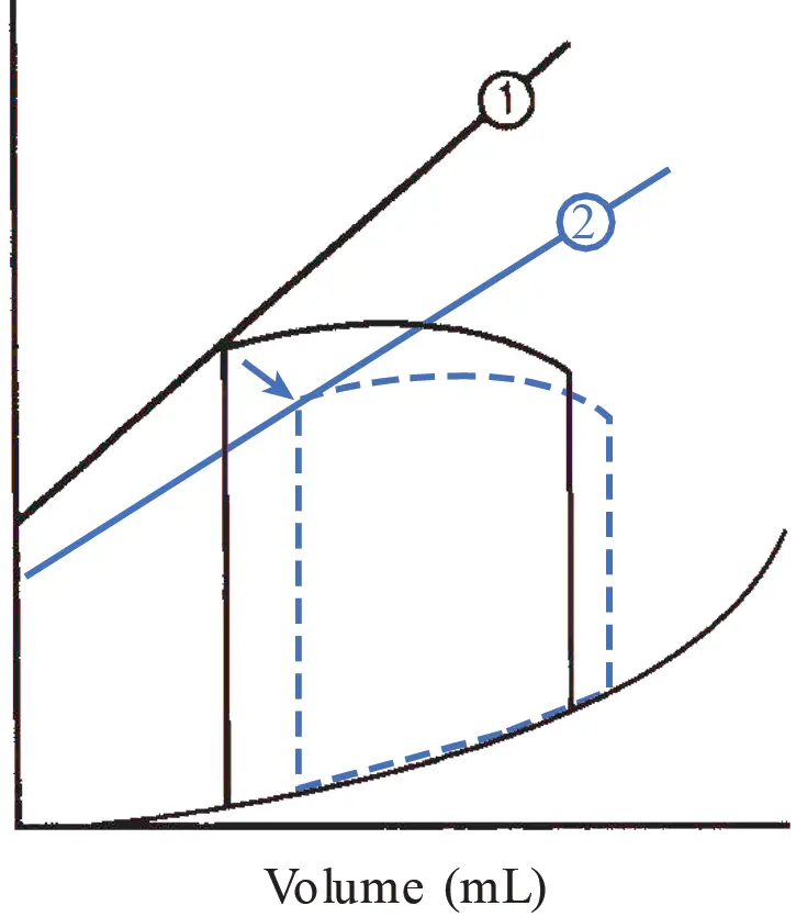 A ventricular pressure-volume loop comparing normal function (solid black line) with heart failure with reduced ejection fraction (HFrEF, blue dashed line). The end-systolic pressure-volume relationship line is shifted downward and rightward (from line 1 to line 2), illustrating impaired contractility, an increased end-systolic volume, and a decreased ejection fraction.